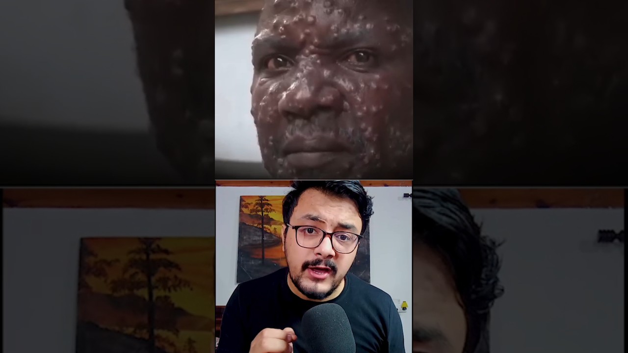 New Pandemic In India!!😷😨 