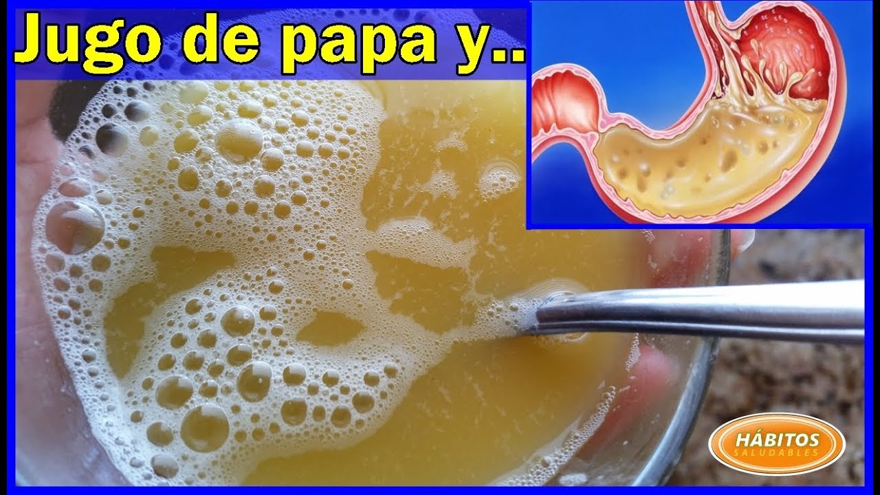 jugo de papa para Aliviar el dolor punzante de la gastritis, y otros