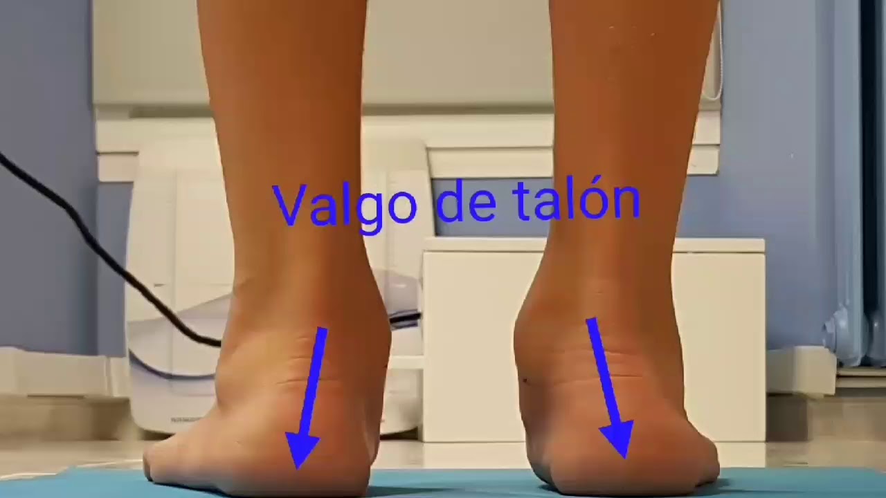 Pie plano en Niño YouTube