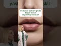Dudaklar Da YaЕџlanД R MД Evet Ama Bu SГјreci Geciktirmek MГјmkГјn Dudaklar Da YaЕџlanД R MД Evet Ama Bu SГјreci Geciktirmek MГјmkГјn