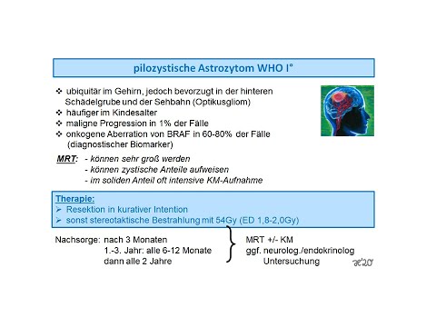 Video: Pilozytisches Astrozytom: Symptome, Überlebensraten Und Behandlung