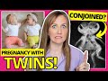 Doctor Explains Twins: Everything You NEED To Know (Conception + Pregnancy + Birth)