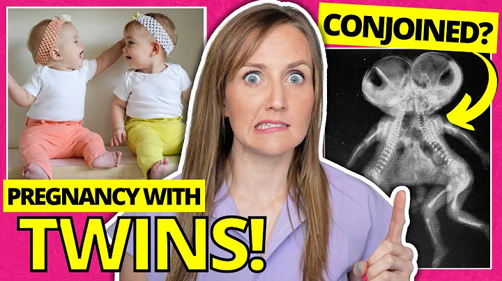 Doctor Explains Twins: Everything You NEED To Know...