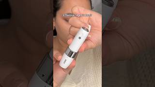 Used Braun Facial Hair Remover for 6 month…THIS HAPPENED. || Electric hair remover