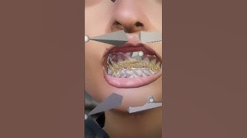 Making A Custom GTA 5 / FiveM Grill 🥶🔥😤 #Shorts #GTA5 #GTAV #GTARP #FiveM #Blender