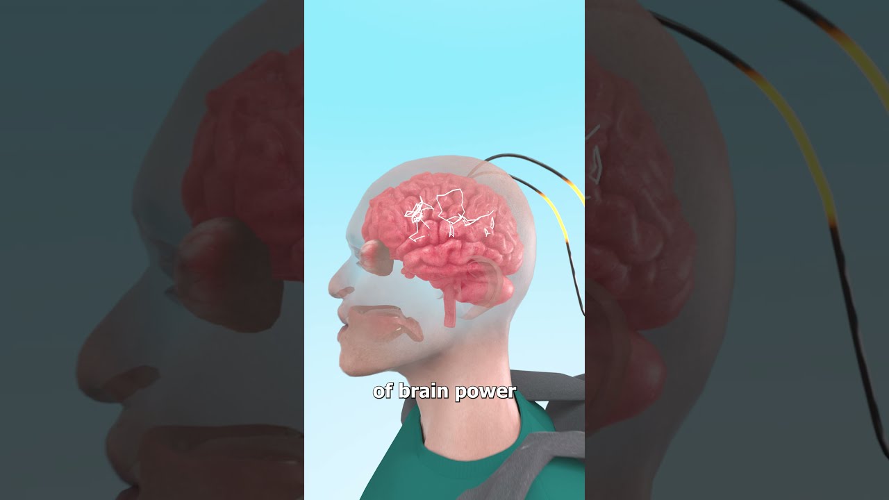 Could Batteries Power Your Brain 