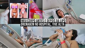 Pode engordar depois da lipo?