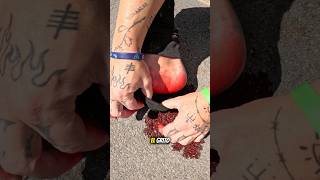 Acabamos En El Hospital