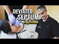 Years of difficulty breathing alleviated! Deviated Septum Adjustment.