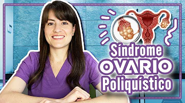 ¿Qué alimentos debo evitar si tengo el síndrome de ovario poliquístico?