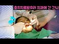 치과는 무서워요ㅠㅠ 충치치료받으러 또 치과에 간 간니~! (치과asmr 치료하러 치과가기 밀착중계 충치치료영상 Dental Care, Dentist )