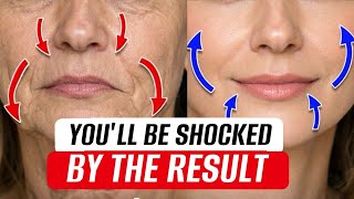 Drooping mouth corners add years to your face 😱 Fix Them Naturally