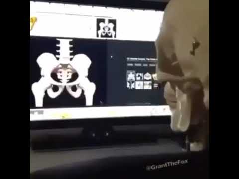 The rare masturbating skeleton