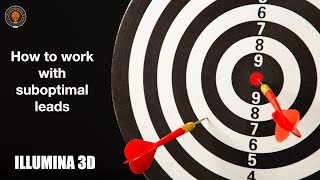 How to work with suboptimal leads screenshot 4
