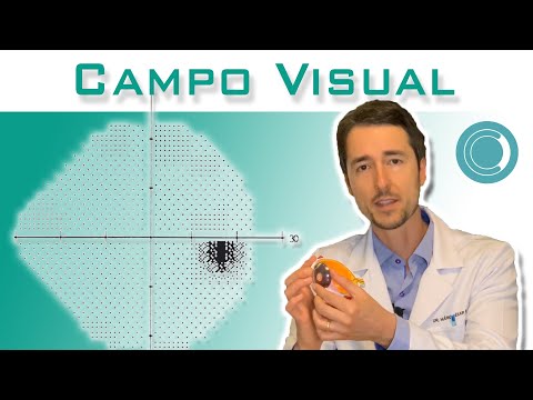 Vídeo: Como obter um teste de campo visual e compreender os resultados