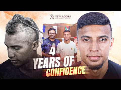 FIFA World Cup 2026: Footballer Jamal Bhuyan's Hair Transplant in Bangladesh ⚽ | New Roots