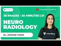 30 Images in 30 minutes | E1 |  | Neuroradiology | NEET PG | Dr. Zainab Vora