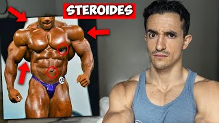 3 Mistakes In steroide aucun effet secondaire That Make You Look Dumb