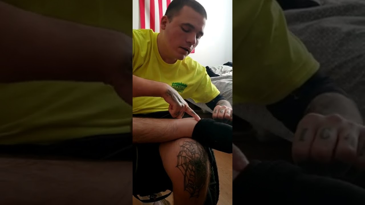 C6 Quadriplegic putting sock on