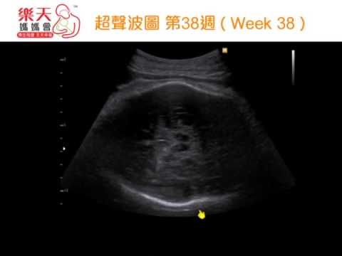 BB 超聲波 - 第38週