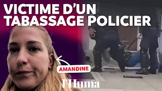Injured by a blow to the left breast: the testimony of a victim of police violence