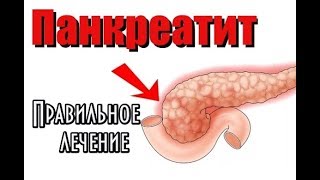 Панкреатит. Правильное лечение. Народные средства Панкреатит. Правильное лечение. Народные средства