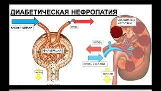 Школа сахарного диабета, встреча 2