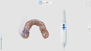 Scan Strategy_Mandible (ENG)