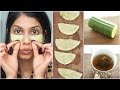 DIY Eye Patches to De-puff eyes &amp; Get Rid of Dark Circles