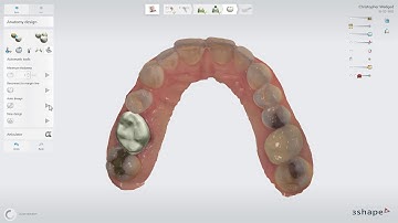 3Shape TRIOS Design Studio -  「鏡像（コピー） 」ツール