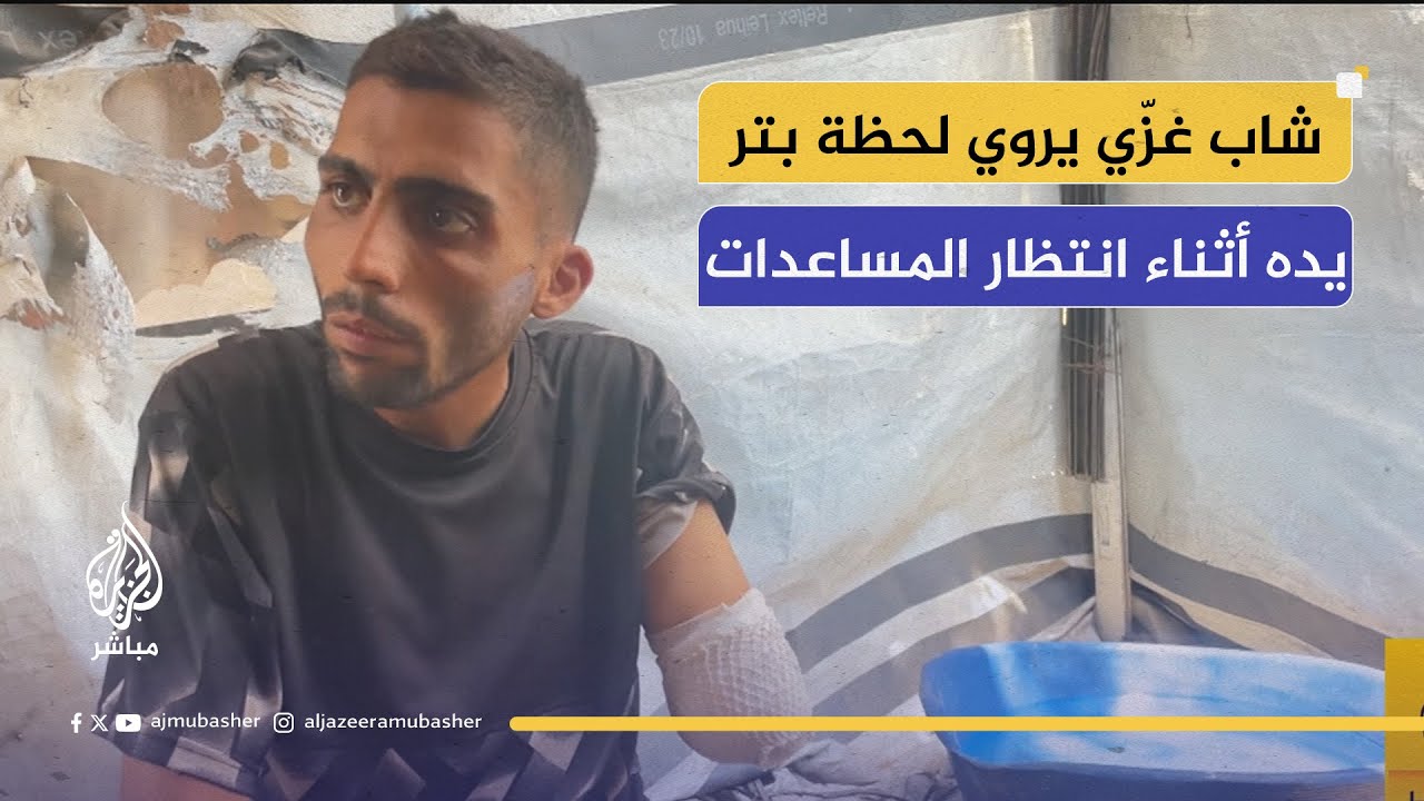 مأساة نازح من غزة.. بُترت يده وهو يبحث عن الغذاء لأطفاله