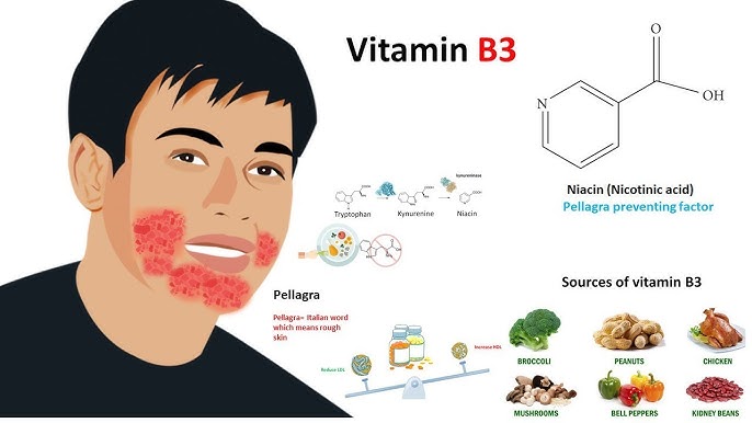 Vitamin B3 - Why is Vitamin B3 (Niacin) Essential For Kids? – Jolly Life,  Inc.