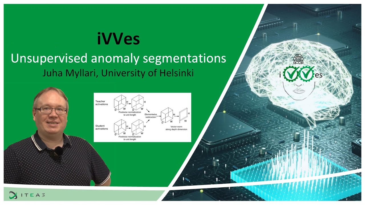 Get better unsupervised anomaly segmentations by measuring your model's behaviour on normal data