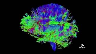 Synaptive Medical