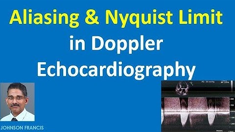 Aliasing and Nyquist Limit in Doppler Echocardiography