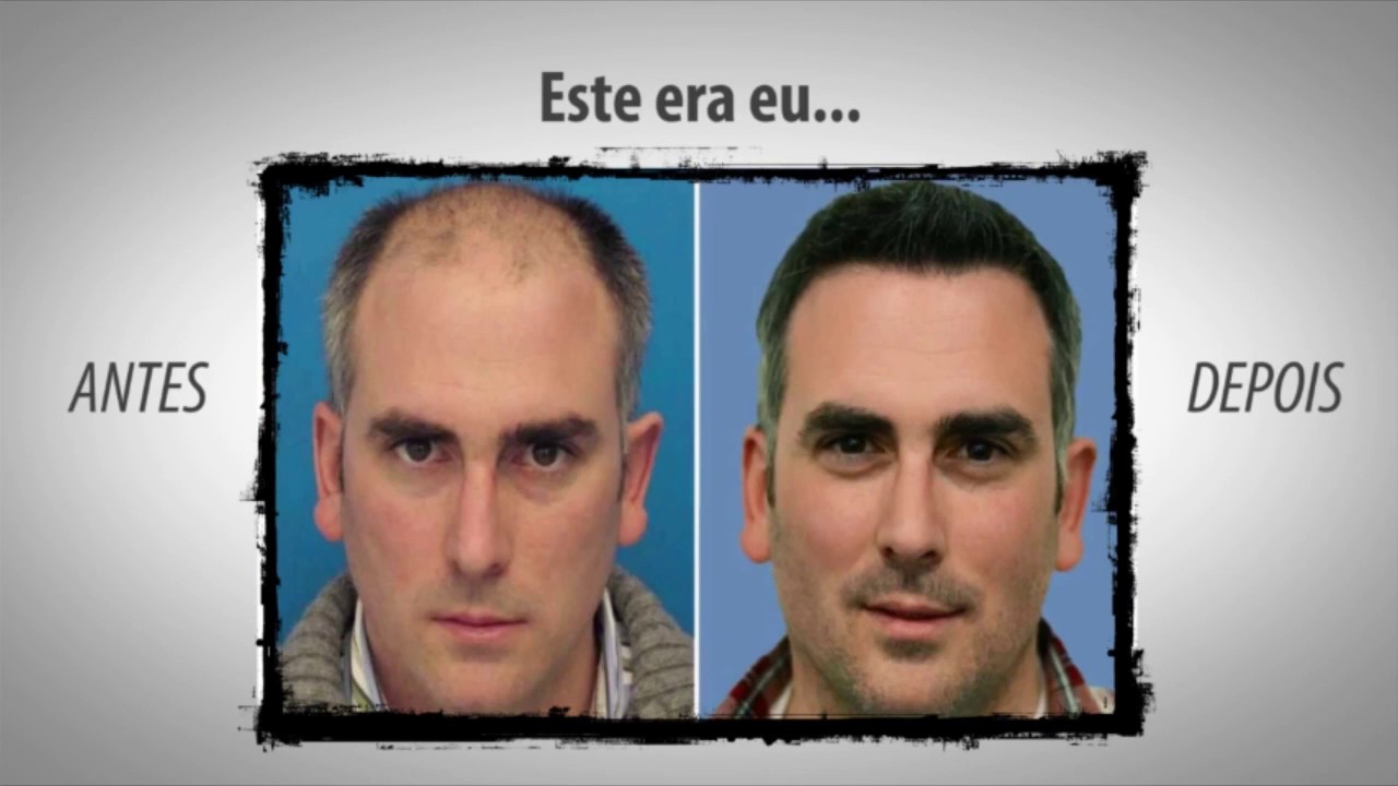 Programa Reconstrução Capilar Funciona? camera iphone 8 plus apk