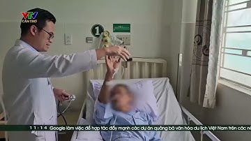 CỨU SỐNG NGƯỜI BỆNH 69 TUỔI ĐỘT QUỴ NHỒI MÁU NÃO DO TẮC ĐỘNG MẠCH THÂN NỀN