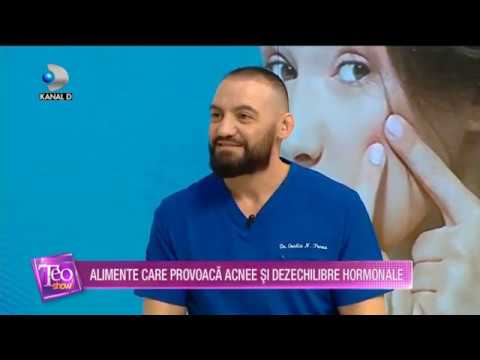 Teo Show (04.02.2020) - Alimente care provoaca acnee si dezechilibre hormonale! "Sfatul medicului"