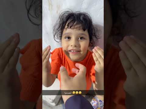 صدمه بسيطه