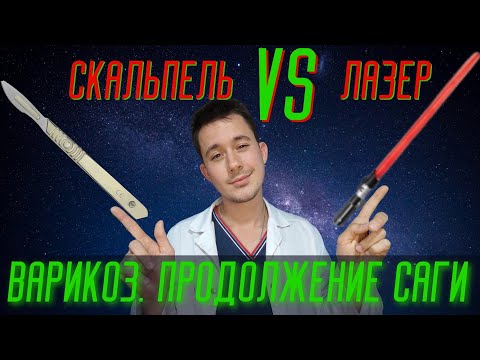 Варикоз! Удаление вен лазером или классическая флебэктомия?