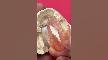 Extremely Flexible Partial