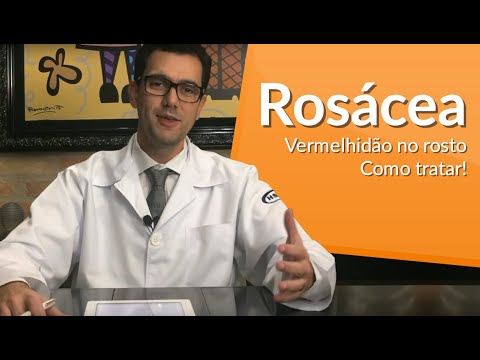Vídeo: Rosácea