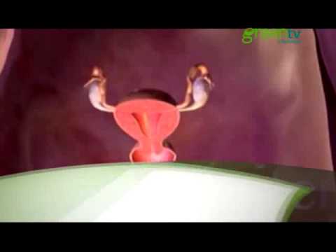 CÁNCER DE OVARIO, CAUSAS Y PREVENCIÓN PGM 152 B4 naturismo herbol tienda
