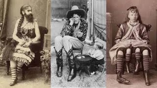 15 Extraordinary People Exploited by Historic Circus Shows