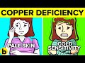 9 Signs You Have Copper Deficiency