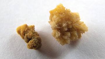 SỎI THẬN - CHUỐI HỘT LÀM TAN SỎI THẬN - LƯƠNG Y HOÀNG DUY TÂN