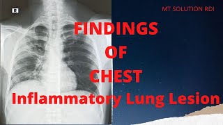 Findings of Inflammatory lung lesion (Ep-25) |Study of chest findings| bangla tutorial screenshot 2