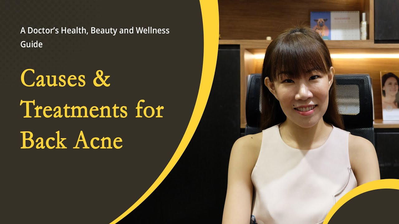 Causes and Treatments for Back Acne YouTube