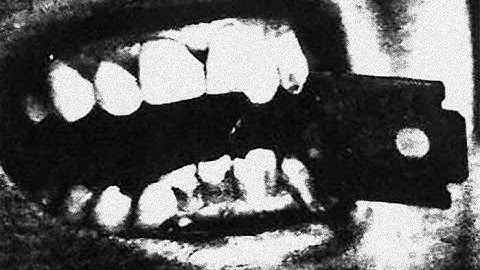 Code 906 - Falling Into it