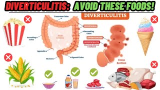 7 Foods To Avoid With Diverticulitis | Diverticulitis Diet | Diverticulitis Foods To Avoid
